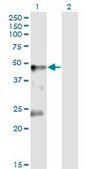 Monoclonal Anti-GLRA1 antibody produced in mouse clone 2E7, purified immunoglobulin, buffered aqueous solution