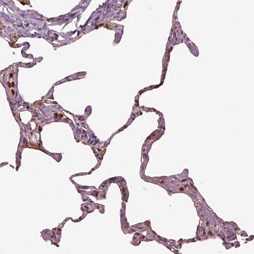 Anti-IL31RA antibody produced in rabbit Prestige Antibodies&#174; Powered by Atlas Antibodies, affinity isolated antibody