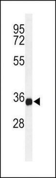 ANTI-TM173(C-TERMINAL) antibody produced in rabbit affinity isolated antibody, buffered aqueous solution