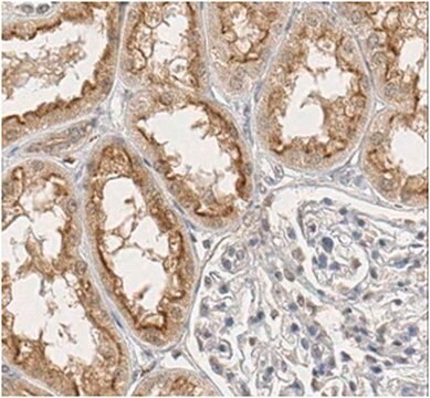 Anti-Osteoprotegerin/TNFRSF11B Antibody from rabbit, purified by affinity chromatography