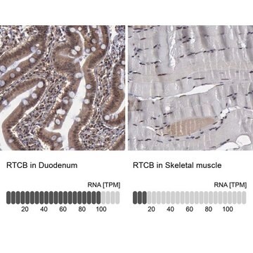 Anti-RTCB antibody produced in rabbit Prestige Antibodies&#174; Powered by Atlas Antibodies, affinity isolated antibody, buffered aqueous glycerol solution