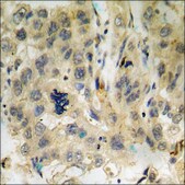 Anti-phospho-p38 MAPK (pTyr182) antibody produced in rabbit affinity isolated antibody