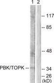 Anti-PBK antibody produced in rabbit affinity isolated antibody