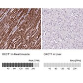 Anti-OXCT1 antibody produced in rabbit Prestige Antibodies&#174; Powered by Atlas Antibodies, affinity isolated antibody, buffered aqueous glycerol solution