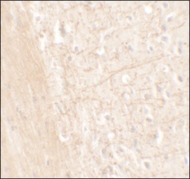 Anti-ERAP1 antibody produced in rabbit affinity isolated antibody