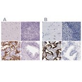 Anti-HSD17B1 antibody produced in rabbit Prestige Antibodies&#174; Powered by Atlas Antibodies, affinity isolated antibody, buffered aqueous glycerol solution