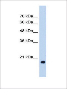 Anti-HSPB6 antibody produced in rabbit IgG fraction of antiserum