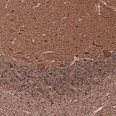 Monoclonal Anti-TUBB3 antibody produced in mouse Prestige Antibodies&#174; Powered by Atlas Antibodies, clone CL5813, purified immunoglobulin, buffered aqueous glycerol solution