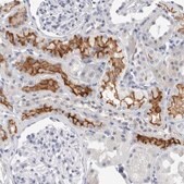 Anti-SLC22A12 antibody produced in rabbit Prestige Antibodies&#174; Powered by Atlas Antibodies, affinity isolated antibody, buffered aqueous glycerol solution