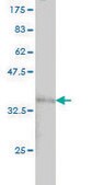 Monoclonal Anti-LAMC1 antibody produced in mouse clone M1, purified immunoglobulin, buffered aqueous solution