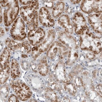 Anti-PDCD11 antibody produced in rabbit Prestige Antibodies&#174; Powered by Atlas Antibodies, affinity isolated antibody, buffered aqueous glycerol solution
