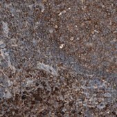 Anti-MMP3 antibody produced in rabbit Prestige Antibodies&#174; Powered by Atlas Antibodies, affinity isolated antibody, buffered aqueous glycerol solution