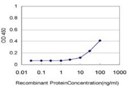 Monoclonal Anti-PNPLA2 antibody produced in mouse clone 2H1, purified immunoglobulin, buffered aqueous solution