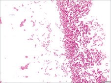 Crystal Violet Solution