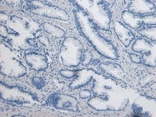 Anti-DPP4/CD26 antibody produced in goat affinity isolated antibody, buffered aqueous solution