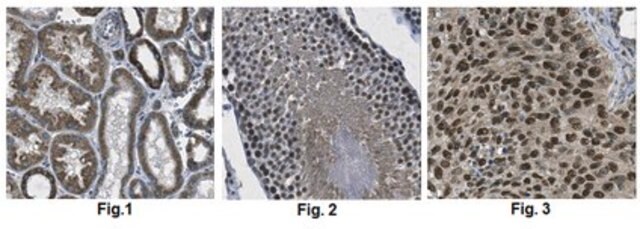 Anti-DNA polymerase beta Antibody from rabbit, purified by affinity chromatography