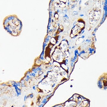 Anti-Transferrin Antibody, clone 1S7G8, Rabbit Monoclonal