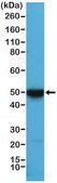 Anti-Cytokeratin 17 (CK-17) antibody, Rabbit monoclonal recombinant, expressed in HEK 293 cells, clone RM351, purified immunoglobulin
