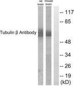 Anti-Tubulin &#946; antibody produced in rabbit affinity isolated antibody
