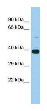 Anti-IST1 (N-terminal) antibody produced in rabbit affinity isolated antibody