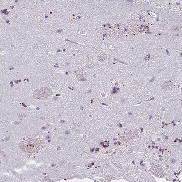 Anti-MOBP antibody produced in rabbit Prestige Antibodies&#174; Powered by Atlas Antibodies, affinity isolated antibody, buffered aqueous glycerol solution