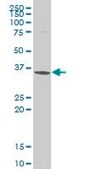 ANTI-SNAI2 antibody produced in mouse clone 4D11, purified immunoglobulin, buffered aqueous solution