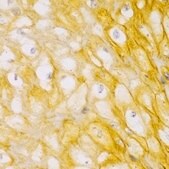 Anti-ACTN1 antibody produced in rabbit