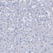 Anti-P2RY12 antibody produced in rabbit Prestige Antibodies&#174; Powered by Atlas Antibodies, affinity isolated antibody, buffered aqueous glycerol solution
