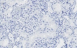 Anti-CDK6 Antibody, clone 2J3 ZooMAb&#174; Rabbit Monoclonal recombinant, expressed in HEK 293 cells
