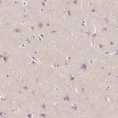 Anti-SSTR4 antibody produced in rabbit Prestige Antibodies&#174; Powered by Atlas Antibodies, affinity isolated antibody, buffered aqueous glycerol solution