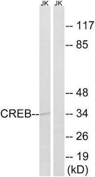 Anti-CREB antibody produced in rabbit affinity isolated antibody