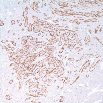 Nerve Growth Factor Receptor (NGFR) (MRQ-21) Mouse Monoclonal Antibody