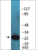 Anti-phospho-ARHGDIA (pSer174) antibody produced in rabbit affinity isolated antibody