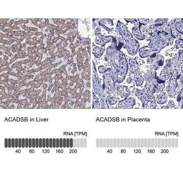 Anti-ACADSB antibody produced in rabbit Prestige Antibodies&#174; Powered by Atlas Antibodies, affinity isolated antibody, buffered aqueous glycerol solution