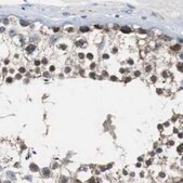 Anti-PITRM1 antibody produced in rabbit Ab2, Prestige Antibodies&#174; Powered by Atlas Antibodies, affinity isolated antibody, buffered aqueous glycerol solution
