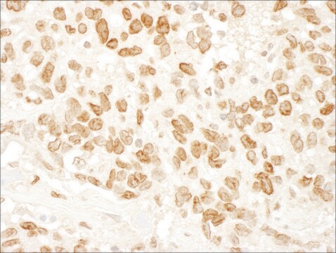 Rabbit anti-ARID4B Antibody, Affinity Purified Powered by Bethyl Laboratories, Inc.