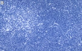 Anti-PKC&#946; Antibody, clone 2E13 ZooMAb&#174; Rabbit Monoclonal recombinant, expressed in HEK 293 cells