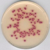 Chromocult&#174; Coliform Agar ISO 9308-1: 2014, For the simultaneous detection and enumeration of coliform bacteria and E. coli