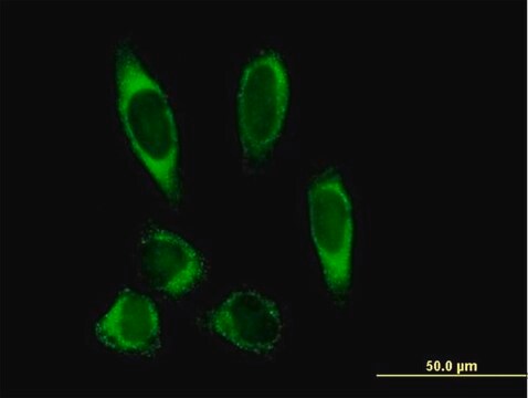 Anti-PLOD2 antibody produced in mouse IgG fraction of antiserum, buffered aqueous solution