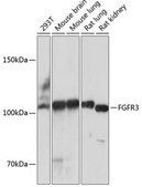 Anti-FGFR3 Antibody, clone 2V1Z6, Rabbit Monoclonal