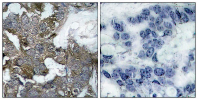 Anti-I&#954;B-&#945; antibody produced in rabbit affinity isolated antibody