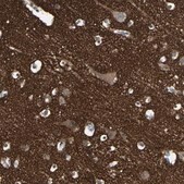 Anti-SV2A antibody produced in rabbit Prestige Antibodies&#174; Powered by Atlas Antibodies, affinity isolated antibody, buffered aqueous glycerol solution