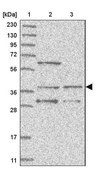 Anti-WDR92 antibody produced in rabbit Prestige Antibodies&#174; Powered by Atlas Antibodies, affinity isolated antibody, buffered aqueous glycerol solution