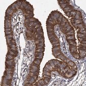 Anti-GCLC antibody produced in rabbit Prestige Antibodies&#174; Powered by Atlas Antibodies, affinity isolated antibody, buffered aqueous glycerol solution