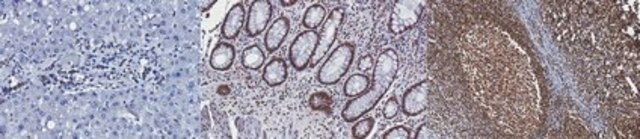 Anti-CREB Antibody, clone LB9, Ascites Free clone LB9, from mouse