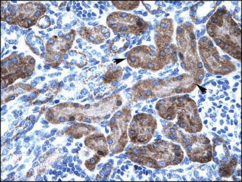 Anti-TRIM31 antibody produced in rabbit affinity isolated antibody