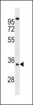 ANTI-SOST(N-TERMINAL) antibody produced in rabbit IgG fraction of antiserum, buffered aqueous solution