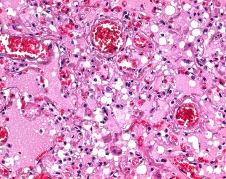 Paraffin pastilles solidification point about 56-58&#176;C for histology