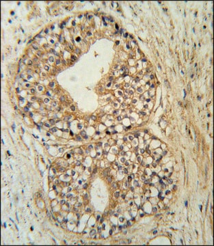 ANTI-ATP11C (CENTER) antibody produced in rabbit IgG fraction of antiserum, buffered aqueous solution