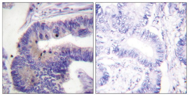 Anti-PDE4D antibody produced in rabbit affinity isolated antibody